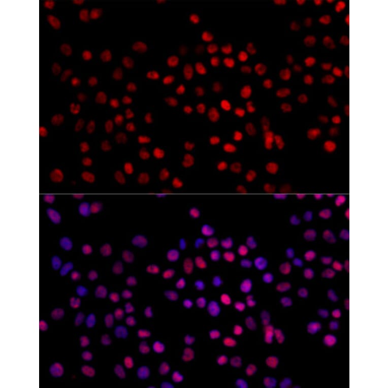 Immunofluorescence - Anti-XRCC4 Antibody (A13589) - Antibodies.com