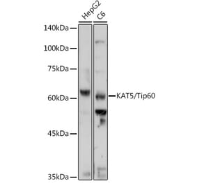 Western Blot - Anti-KAT5 / Tip60 Antibody (A13590) - Antibodies.com