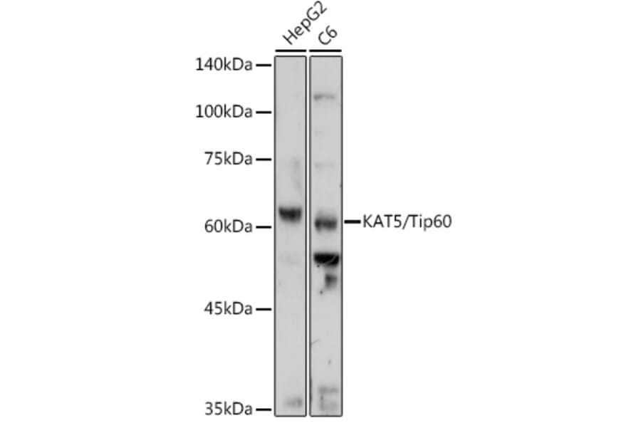 Western Blot - Anti-KAT5/Tip60 Antibody (A13590) - Antibodies.com