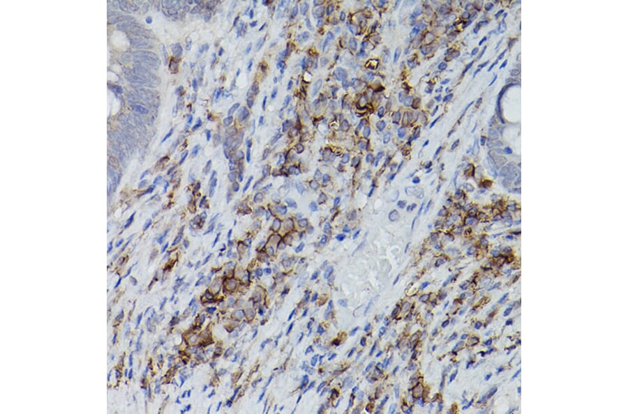 Immunohistochemistry - Anti-CD38 Antibody (A13591) - Antibodies.com