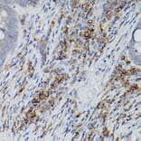 Immunohistochemistry - Anti-CD38 Antibody (A13591) - Antibodies.com