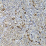 Immunohistochemistry - Anti-CD38 Antibody (A13591) - Antibodies.com