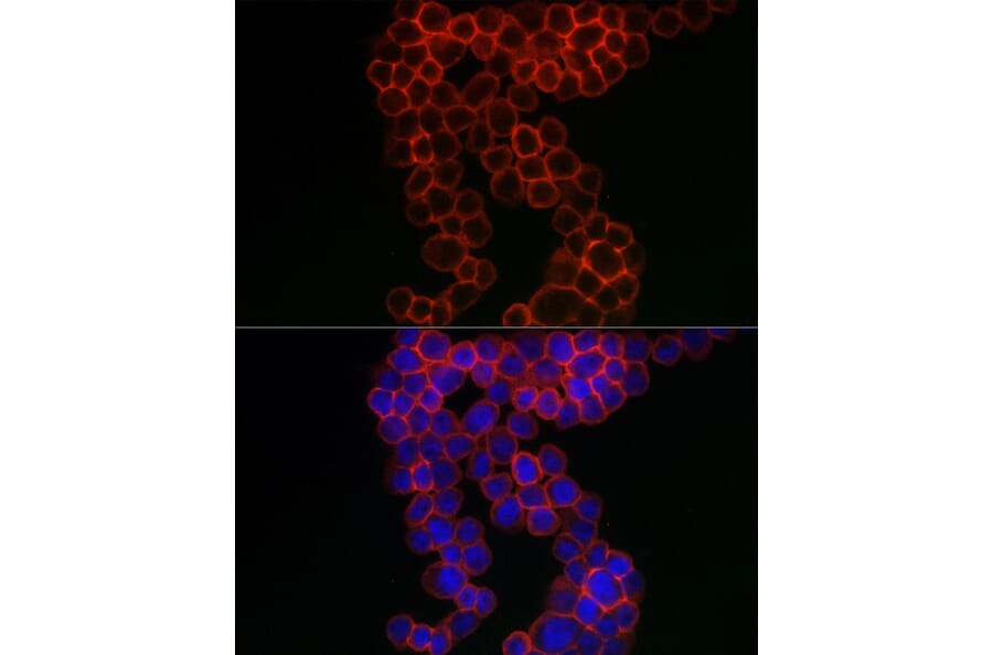 Immunofluorescence - Anti-CD38 Antibody (A13591) - Antibodies.com