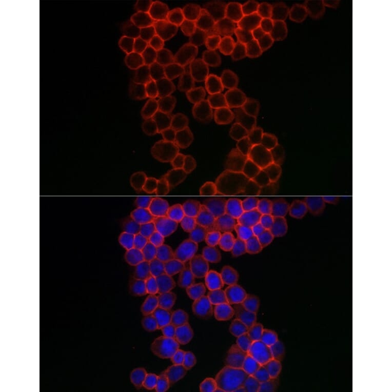 Immunofluorescence - Anti-CD38 Antibody (A13591) - Antibodies.com