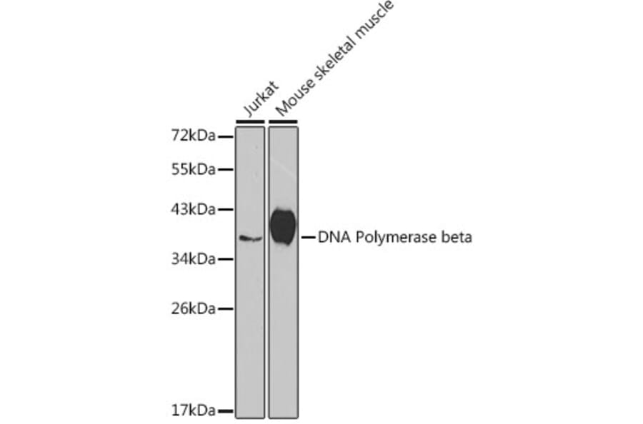 Western Blot - Anti-DNA Polymerase beta Antibody (A13592) - Antibodies.com