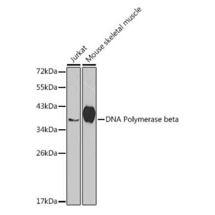 Western Blot - Anti-DNA Polymerase beta Antibody (A13592) - Antibodies.com