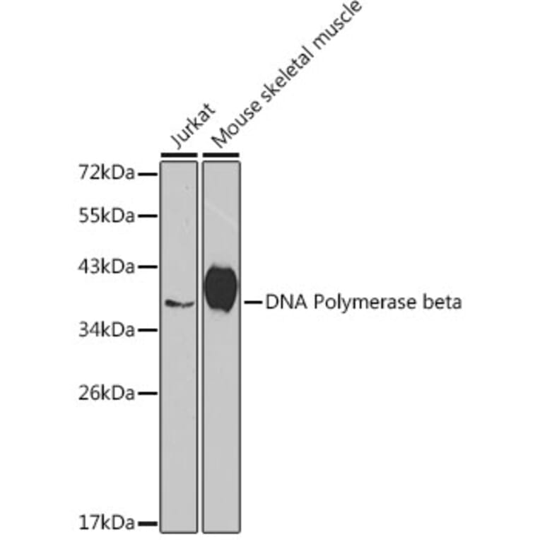 Western Blot - Anti-DNA Polymerase beta Antibody (A13592) - Antibodies.com