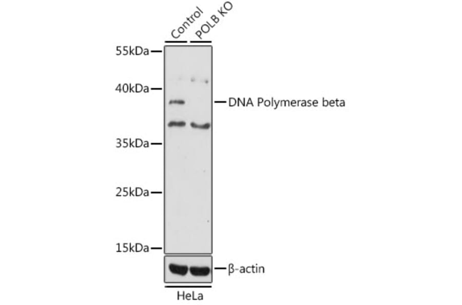 Western Blot - Anti-DNA Polymerase beta Antibody (A13592) - Antibodies.com
