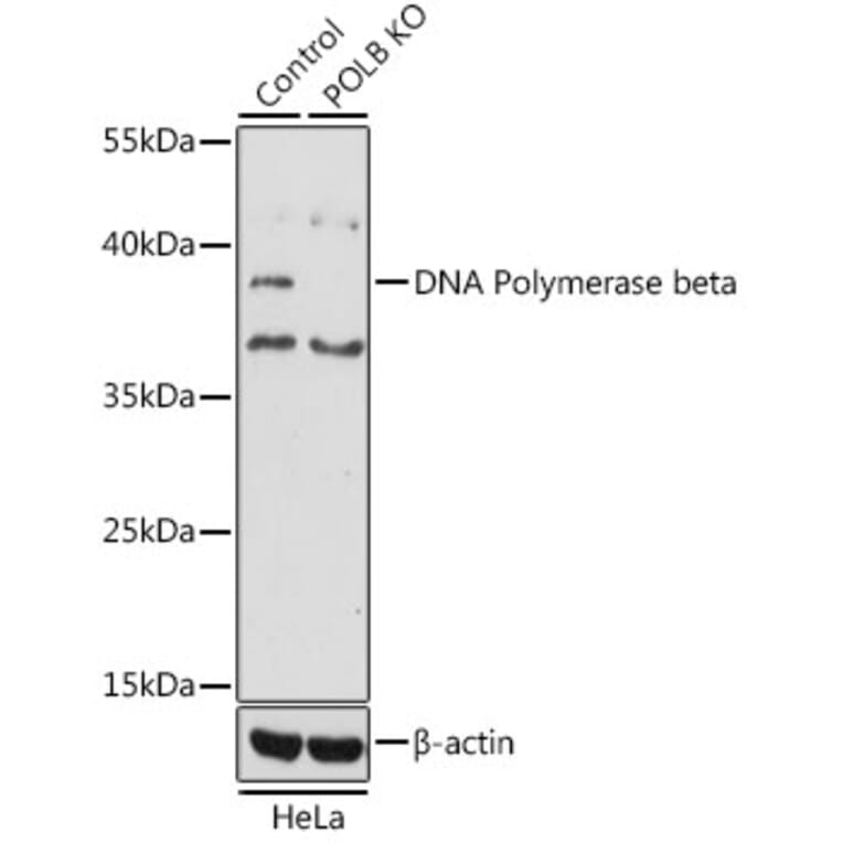Western Blot - Anti-DNA Polymerase beta Antibody (A13592) - Antibodies.com