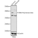 Western Blot - Anti-DNA Polymerase beta Antibody (A13592) - Antibodies.com