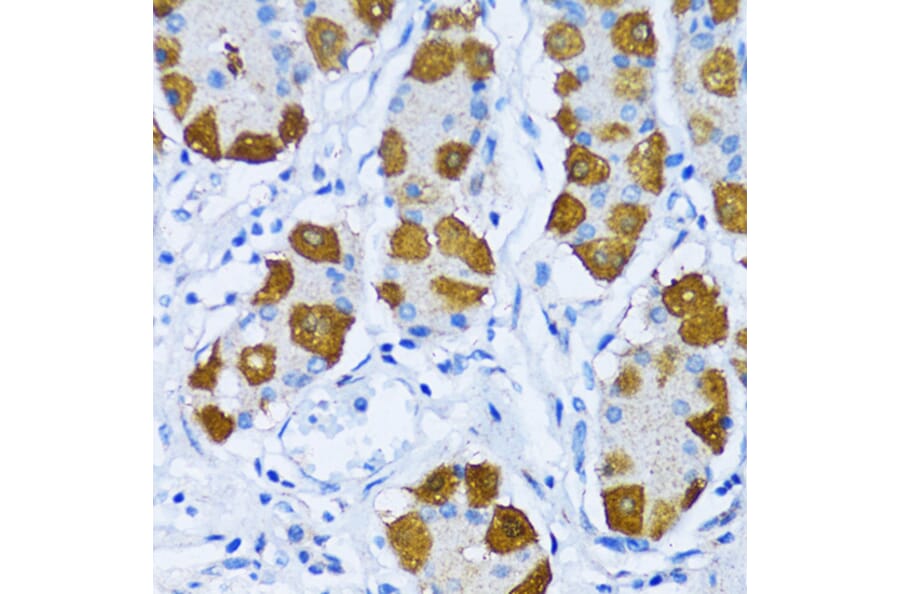 Immunohistochemistry - Anti-DNA Polymerase beta Antibody (A13592) - Antibodies.com
