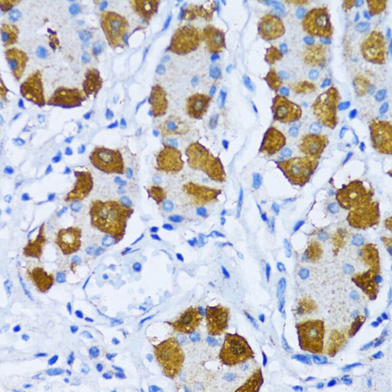 Immunohistochemistry - Anti-DNA Polymerase beta Antibody (A13592) - Antibodies.com