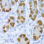 Immunohistochemistry - Anti-DNA Polymerase beta Antibody (A13592) - Antibodies.com