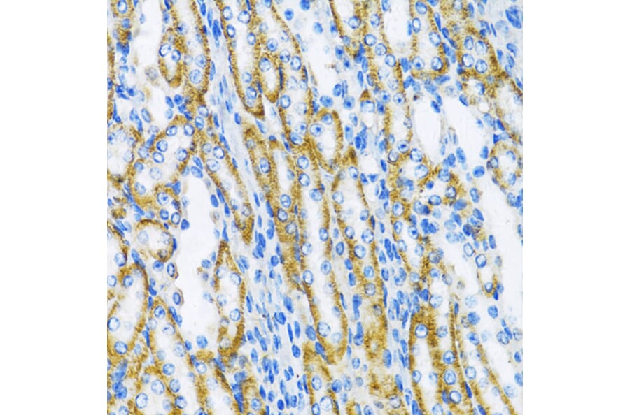 Immunohistochemistry - Anti-DNA Polymerase beta Antibody (A13592) - Antibodies.com