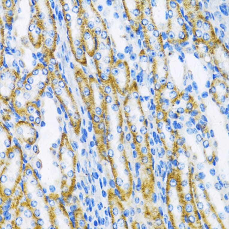 Immunohistochemistry - Anti-DNA Polymerase beta Antibody (A13592) - Antibodies.com