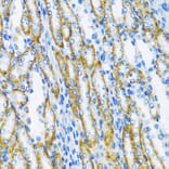 Immunohistochemistry - Anti-DNA Polymerase beta Antibody (A13592) - Antibodies.com