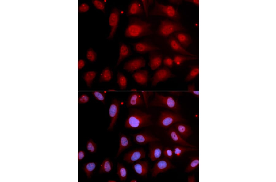 Immunofluorescence - Anti-DNA Polymerase beta Antibody (A13592) - Antibodies.com