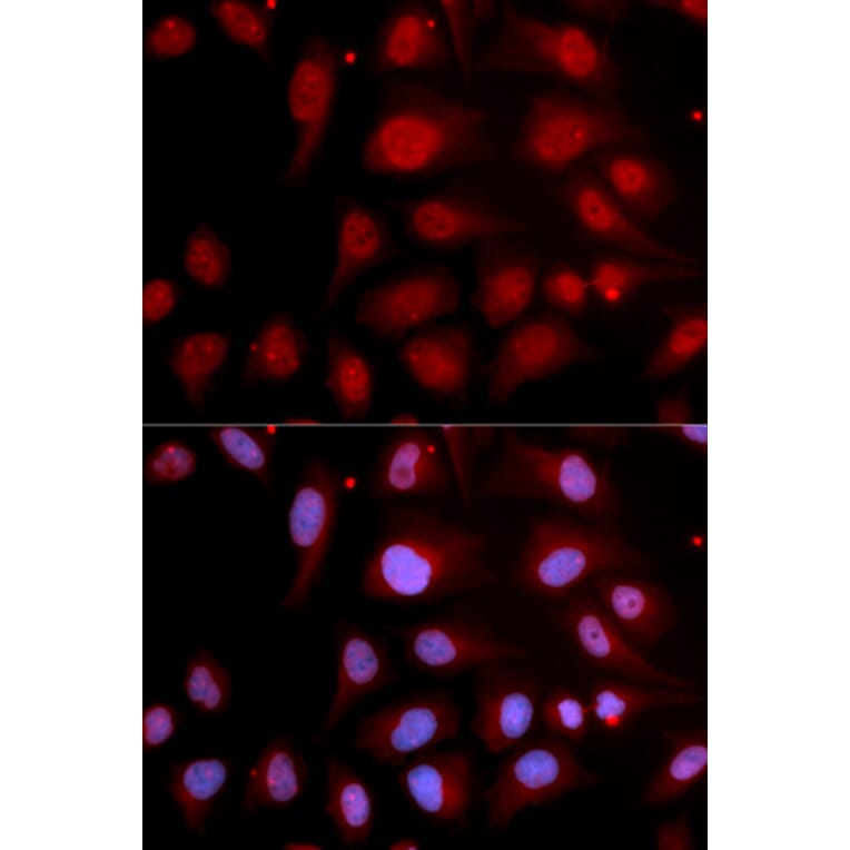 Immunofluorescence - Anti-DNA Polymerase beta Antibody (A13592) - Antibodies.com
