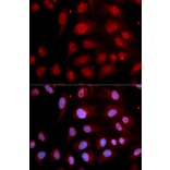 Immunofluorescence - Anti-DNA Polymerase beta Antibody (A13592) - Antibodies.com
