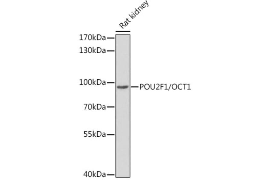 Western Blot - Anti-OCT1 Antibody (A13593) - Antibodies.com