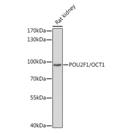 Western Blot - Anti-OCT1 Antibody (A13593) - Antibodies.com