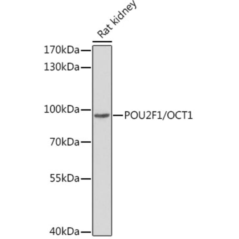 Western Blot - Anti-OCT1 Antibody (A13593) - Antibodies.com
