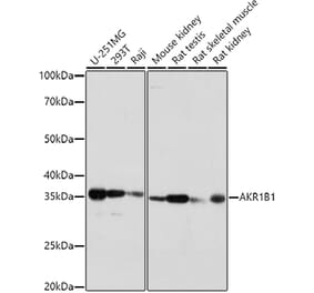 Western Blot - Anti-Aldose reductase Antibody (A13594) - Antibodies.com
