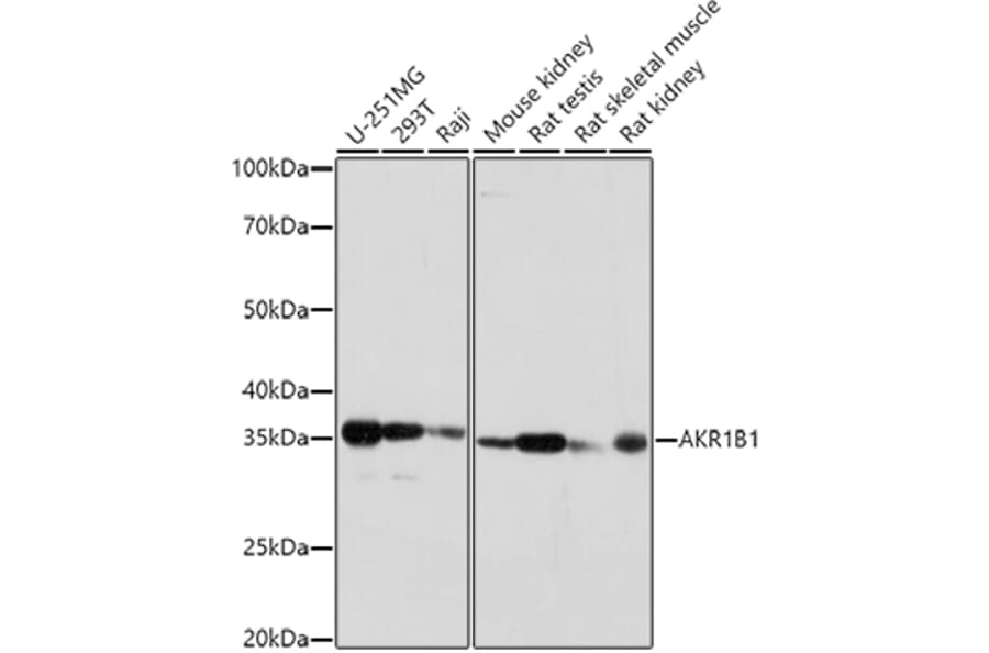 Western Blot - Anti-Aldose reductase Antibody (A13594) - Antibodies.com