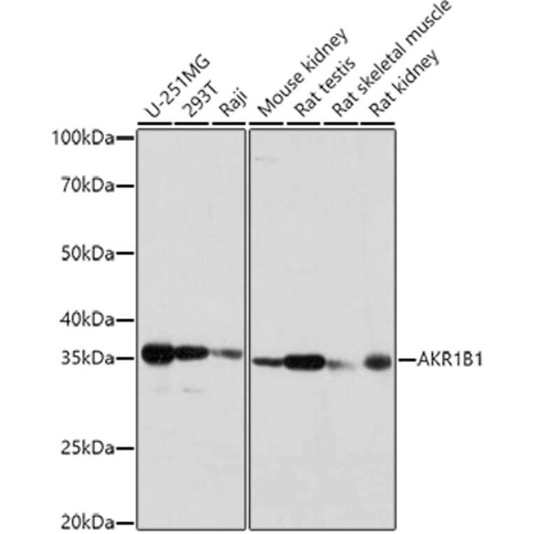 Western Blot - Anti-Aldose reductase Antibody (A13594) - Antibodies.com