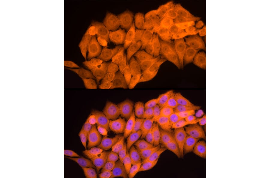 Immunofluorescence - Anti-Aldose reductase Antibody (A13594) - Antibodies.com