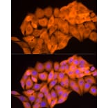 Immunofluorescence - Anti-Aldose reductase Antibody (A13594) - Antibodies.com