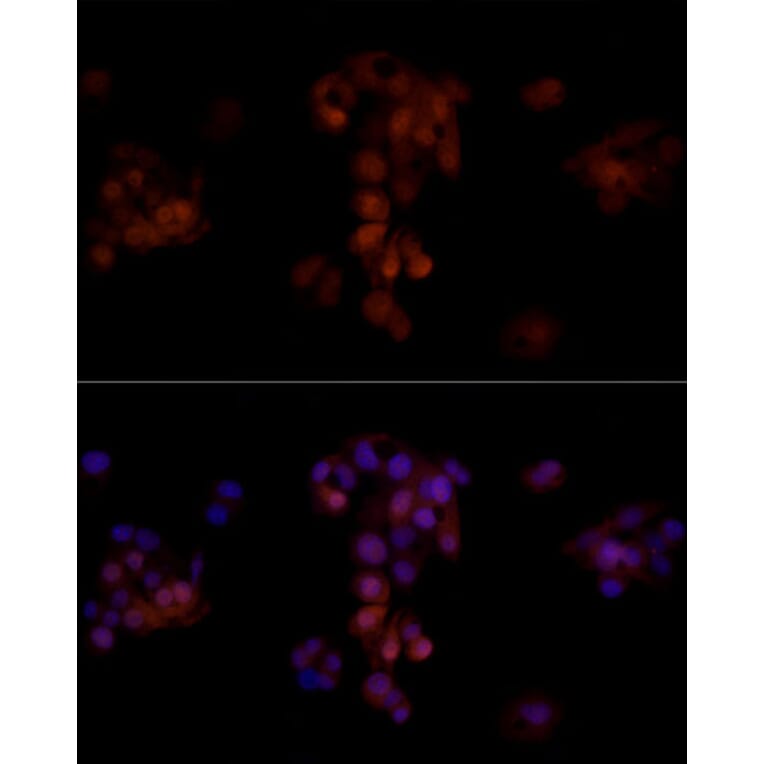 Immunofluorescence - Anti-Aldose reductase Antibody (A13594) - Antibodies.com