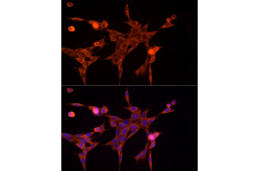Immunofluorescence - Anti-Aldose reductase Antibody (A13594) - Antibodies.com