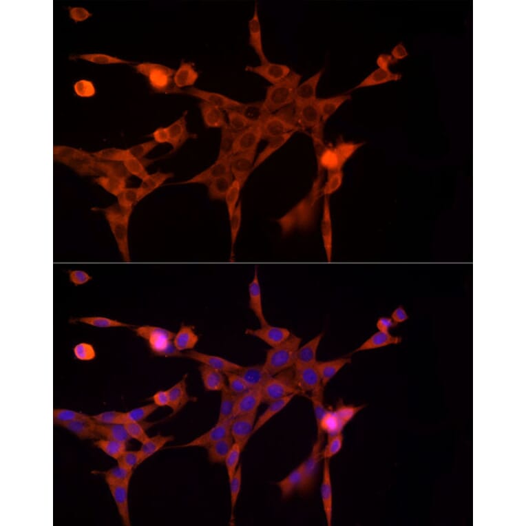 Immunofluorescence - Anti-Aldose reductase Antibody (A13594) - Antibodies.com