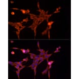 Immunofluorescence - Anti-Aldose reductase Antibody (A13594) - Antibodies.com