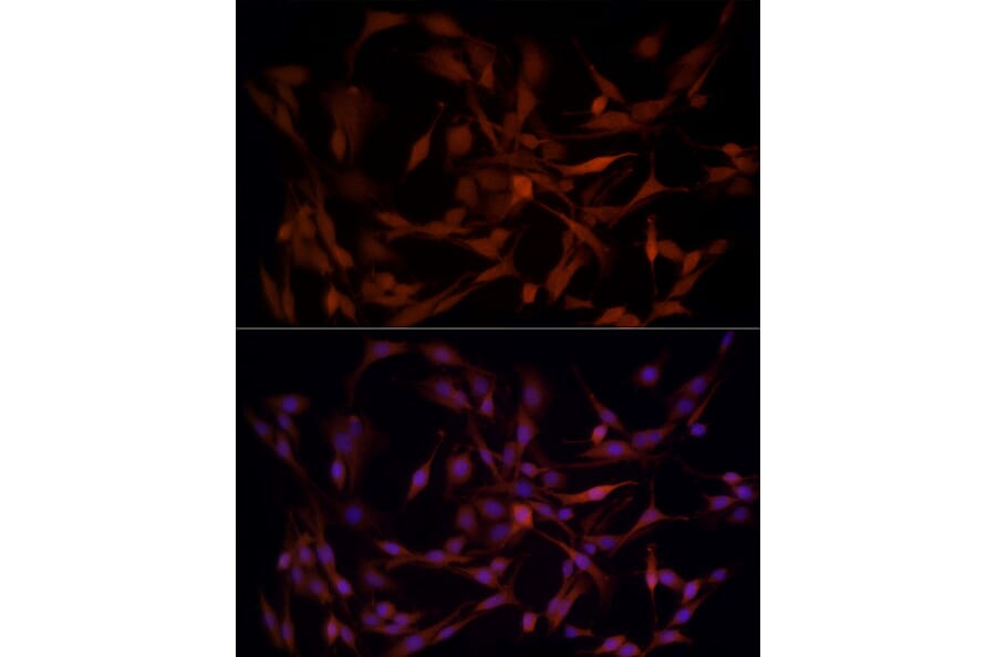 Immunofluorescence - Anti-Aldose reductase Antibody (A13594) - Antibodies.com