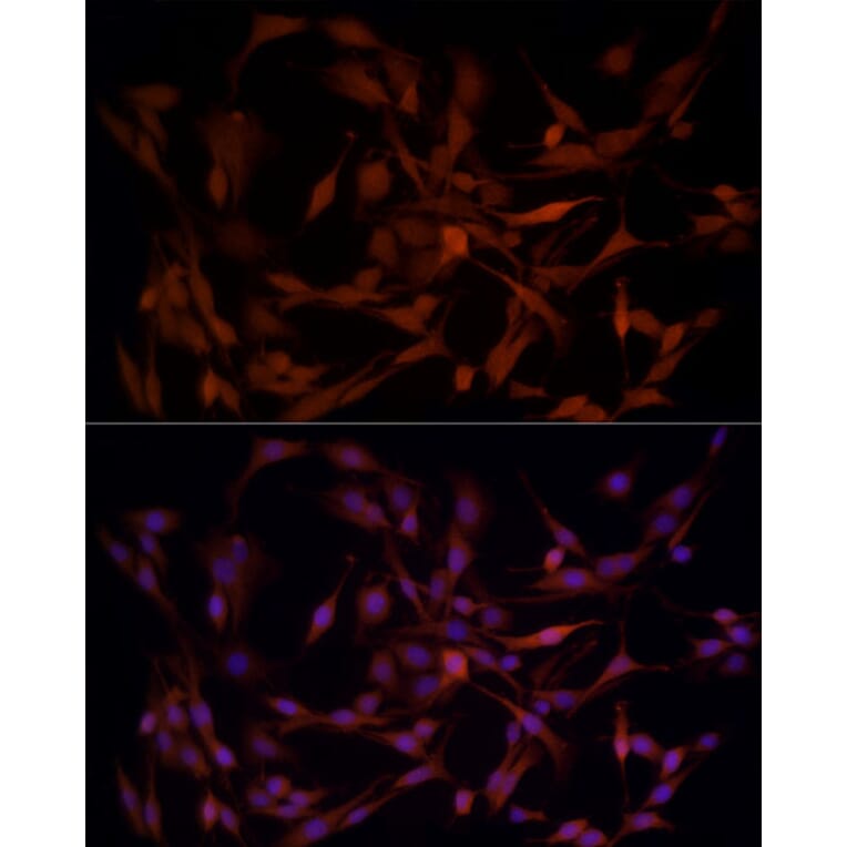 Immunofluorescence - Anti-Aldose reductase Antibody (A13594) - Antibodies.com