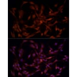 Immunofluorescence - Anti-Aldose reductase Antibody (A13594) - Antibodies.com