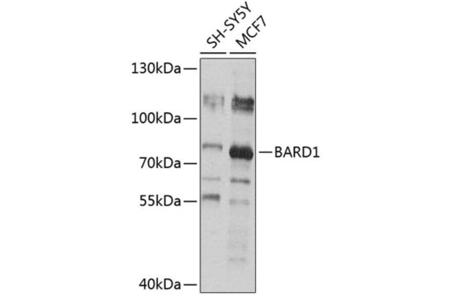 Western Blot - Anti-BARD1 Antibody (A13595) - Antibodies.com