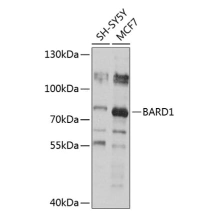 Western Blot - Anti-BARD1 Antibody (A13595) - Antibodies.com