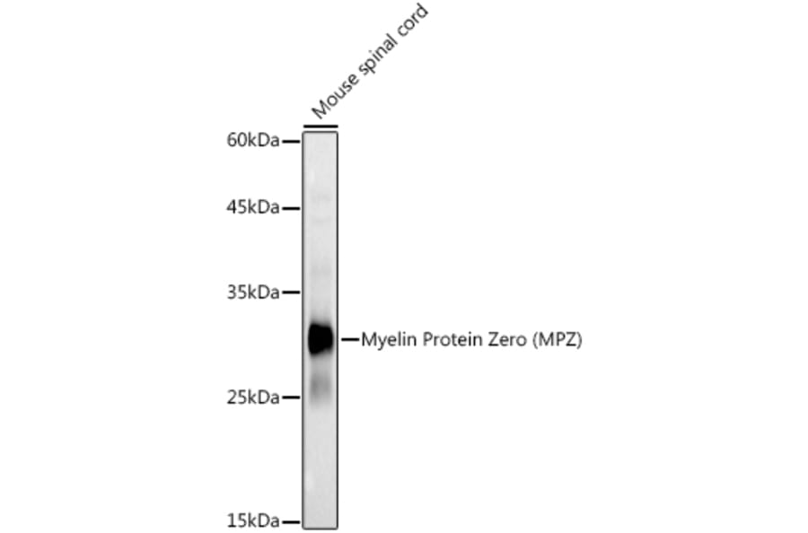 Western Blot - Anti-Myelin Protein Zero Antibody (A13596) - Antibodies.com