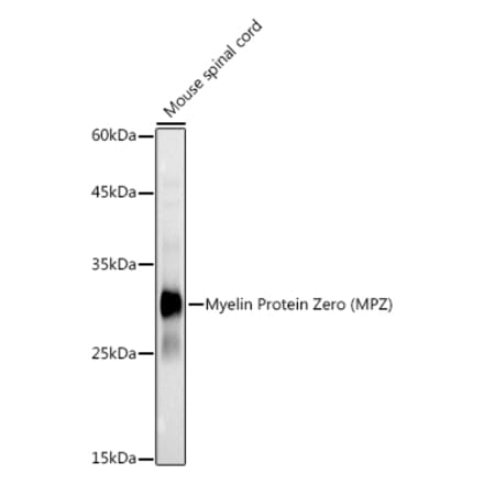 Western Blot - Anti-Myelin Protein Zero Antibody (A13596) - Antibodies.com