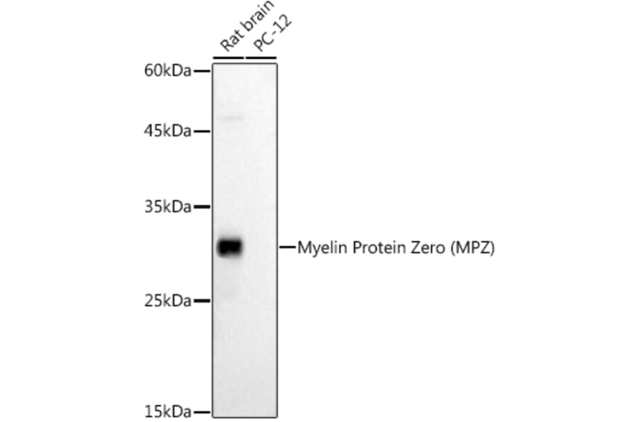 Western Blot - Anti-Myelin Protein Zero Antibody (A13596) - Antibodies.com