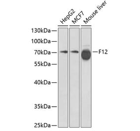 Western Blot - Anti-Factor XII Antibody (A13597) - Antibodies.com