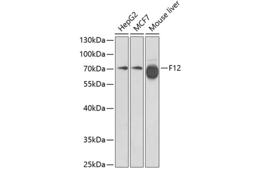 Western Blot - Anti-Factor XII Antibody (A13597) - Antibodies.com