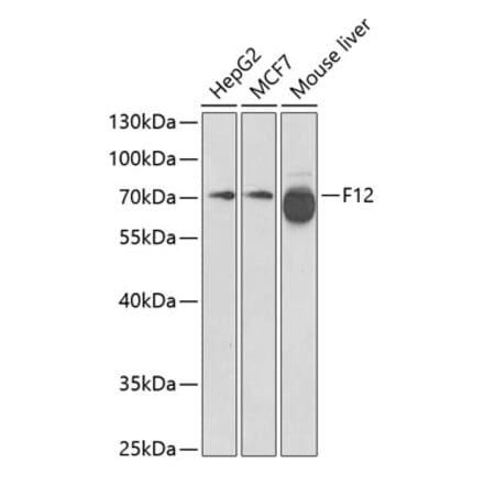 Western Blot - Anti-Factor XII Antibody (A13597) - Antibodies.com