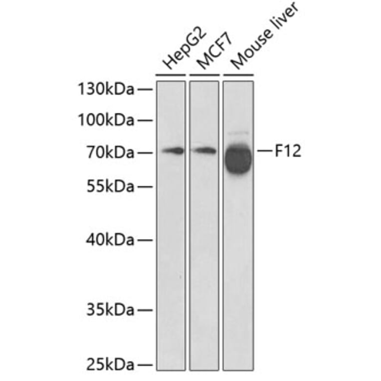 Western Blot - Anti-Factor XII Antibody (A13597) - Antibodies.com