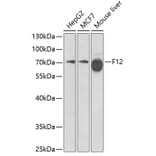 Western Blot - Anti-Factor XII Antibody (A13597) - Antibodies.com