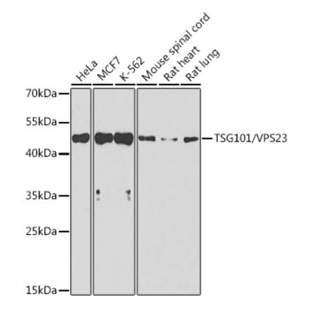 Western Blot - Anti-TSG101 Antibody (A13598) - Antibodies.com