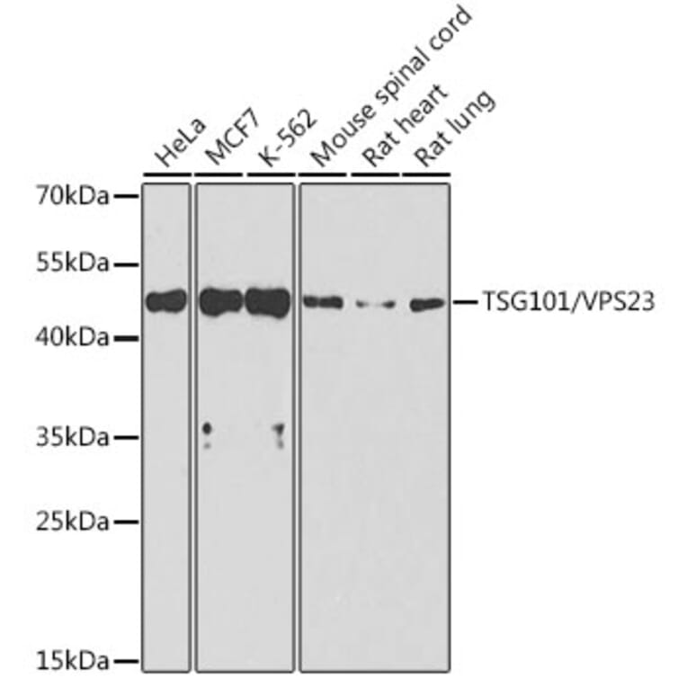 Western Blot - Anti-TSG101 Antibody (A13598) - Antibodies.com